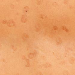 Seamless Textures of Human Skin + Normal & Bump Mapping